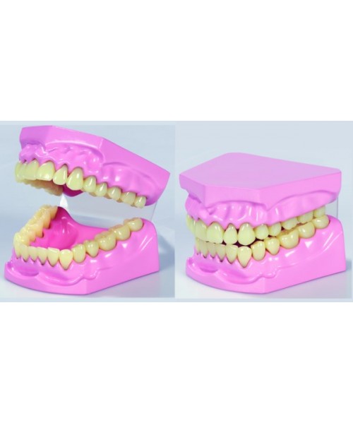 Modelo dental apertura total 2