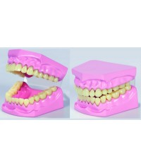 Modelo dental apertura total